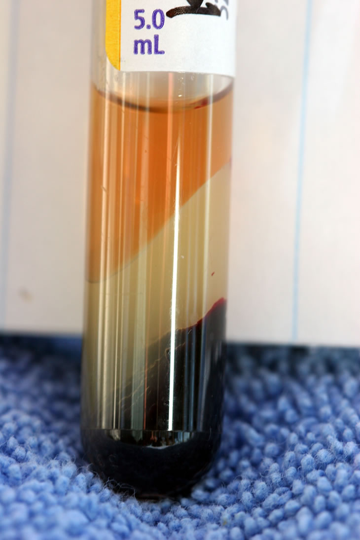 Vacutainer after centrifugation